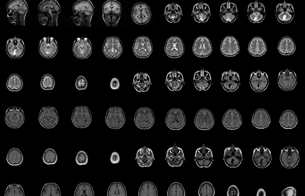 neuro-aftergrad